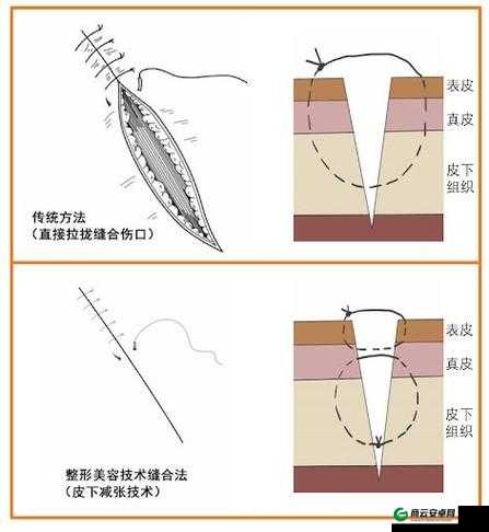 竹板打肿臂缝合不上：被打者的惨痛经历